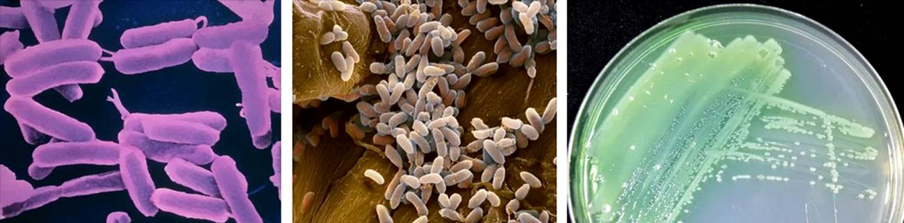 Бактерии артробактер и псевдомонады