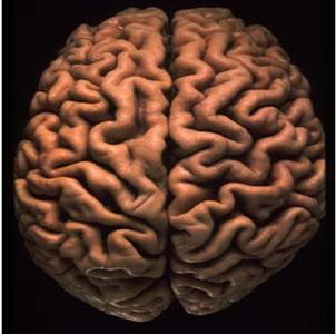 -1: Cerebral hemispheres from above